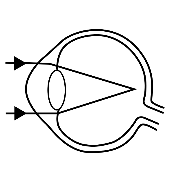 Myopia Management